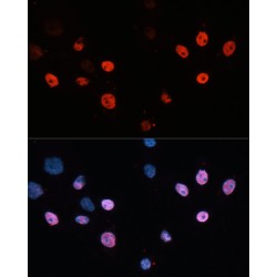 Histone Deacetylase 3 (HDAC3) Antibody