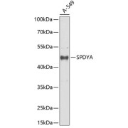 Western blot analysis of extracts of A549 cells using SPDYA Antibody (1/1000 dilution).