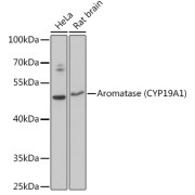 Western blot analysis of extracts of various cell lines using Aromatase (CYP19A1) Antibody (1/3000 dilution).