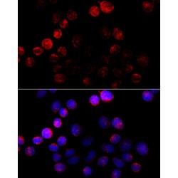 Aromatase (CYP19A1) Antibody