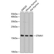 Western blot analysis of extracts of various cell lines using STMN1 Antibody (1/1000 dilution).