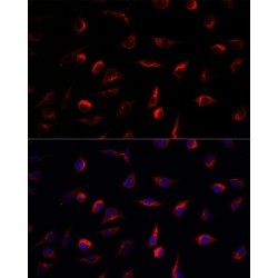 Dual Specificity Mitogen-Activated Protein Kinase Kinase 7 (MAP2K7) Antibody