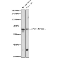 Ribosomal Protein S6 Kinase Beta 1 (RPS6KB1) Antibody