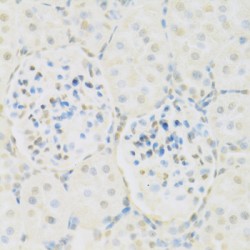 Histone Acetyltransferase KAT2A (KAT2A) Antibody