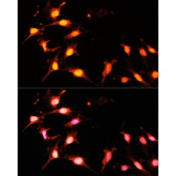 Histone Acetyltransferase KAT2A (KAT2A) Antibody