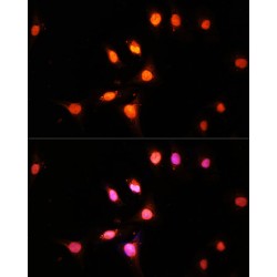 Histone Acetyltransferase KAT2A (KAT2A) Antibody