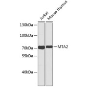 Western blot analysis of extracts of various cell lines using MTA2 Antibody.