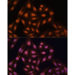 Chromobox Protein Homolog 3 (CBX3) Antibody