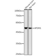 Western blot analysis of extracts of various cell lines using AP2M1 Antibody (1/500 dilution).