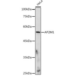 AP-2 Complex Subunit Mu (AP2M1) Antibody