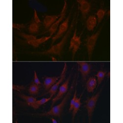 Bone Marrow Proteoglycan (PRG2) Antibody