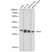 Western blot analysis of extracts of various cell lines using RPS3 Antibody (1/1000 dilution).