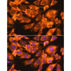 40S Ribosomal Protein S3 (RPS3) Antibody