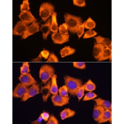 40S Ribosomal Protein S3 (RPS3) Antibody