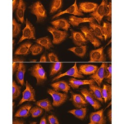 40S Ribosomal Protein S3 (RPS3) Antibody