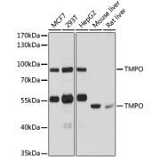 Western blot analysis of extracts of various cell lines using TMPO Antibody (1/1000 dilution).