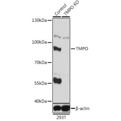 Thymopoietin (TMPO) Antibody