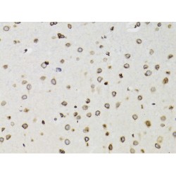 Thymopoietin (TMPO) Antibody