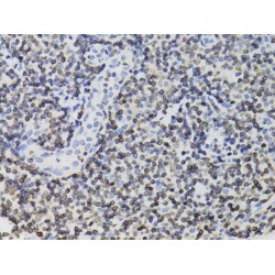 Thymopoietin (TMPO) Antibody