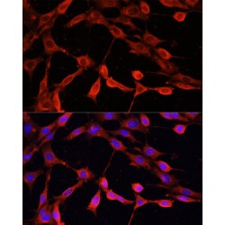 Deoxyribonuclease-1 (DNASE1) Antibody