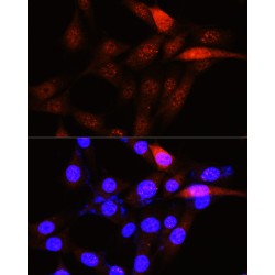 Serine/threonine-Protein Kinase PLK1 (PLK1) Antibody