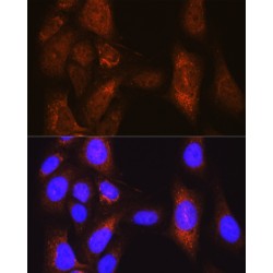 Serine/threonine-Protein Kinase PLK1 (PLK1) Antibody