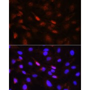 Immunofluorescence analysis of C6 cells using PLK1 Antibody (1/100 dilution, 40x lens). Blue: DAPI for nuclear staining.