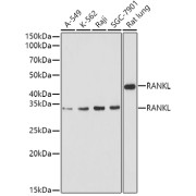 Western blot analysis of extracts of various cell lines using RANKL Antibody (1/1000 dilution).