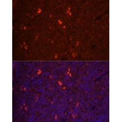 Tumor Necrosis Factor Ligand Superfamily Member 11 / RANKL (TNFSF11) Antibody