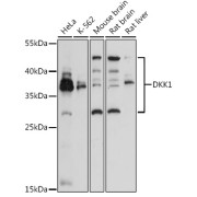 Western blot analysis of extracts of various cell lines using DKK1 Antibody (1/3000 dilution).