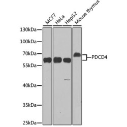 Programmed Cell Death Protein 4 (PDCD4) Antibody