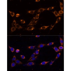 Heat Shock Protein 75 kDa , Mitochondrial (TRAP1) Antibody