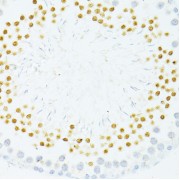 Immunohistochemistry of paraffin-embedded Rat testis using PVALB Antibody (1/100 dilution, 40x lens).