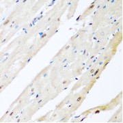 Immunohistochemistry of paraffin-embedded Rat heart using VCP Antibody (1/200 dilution, 40x lens).