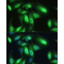 Transitional Endoplasmic Reticulum ATPase (VCP) Antibody