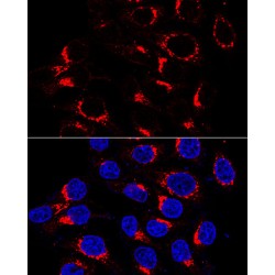 USO1 Vesicle Transport Factor (USO1) Antibody