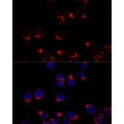 USO1 Vesicle Transport Factor (USO1) Antibody