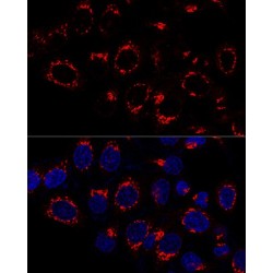 USO1 Vesicle Transport Factor (USO1) Antibody