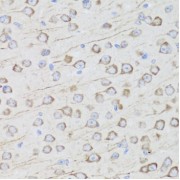 Immunohistochemistry of paraffin-embedded Mouse brain using MIP Antibody (1/100 dilution, 40x lens).