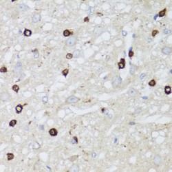 Aquaporin-0 (AQP0) Antibody