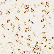 Immunohistochemistry of paraffin-embedded Rat brain using LAMP3 Antibody (1/200 dilution, 40x lens).