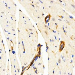 Lysosomal Associated Membrane Protein 3 (LAMP3) Antibody