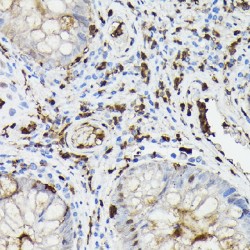 Gelsolin (GSN) Antibody