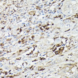 Gelsolin (GSN) Antibody