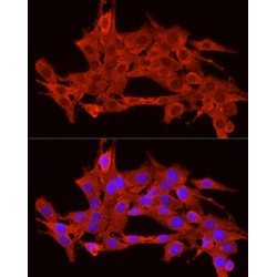 Adrenocorticotropic Hormone (ACTH) Antibody