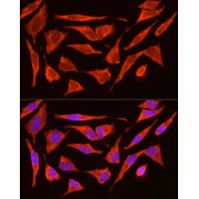 Immunofluorescence analysis of HeLa cells using POMC Antibody (1/200 dilution, 40x lens). Blue: DAPI for nuclear staining.