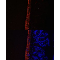 Myosin Light Chain 9, Regulatory (MYL9) Antibody