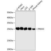 Western blot analysis of extracts of various cell lines using PRDX3 Antibody (1/3000 dilution).