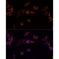 Thioredoxin-Dependent Peroxide Reductase, Mitochondrial (PRDX3) Antibody