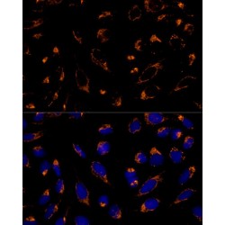 Thioredoxin-Dependent Peroxide Reductase, Mitochondrial (PRDX3) Antibody